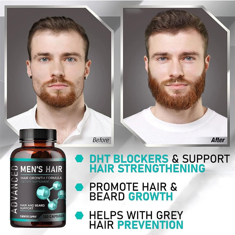 Clinically Proven Hair Growth Capsules for Men with 5000mcg Biotin and Saw Palmetto for Thicker Stronger Hair