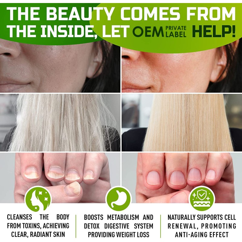 Customized Organic Vegan Sea Moss Gummies with Bladderwrack and Burdock Root for Immune Support and Vitality