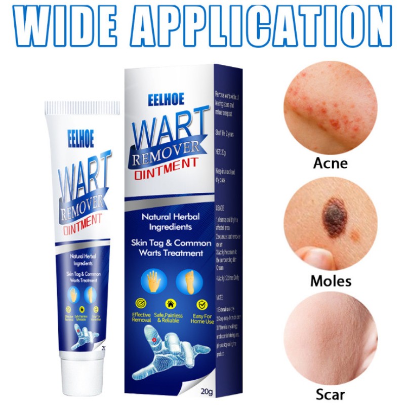 Wart Remover Supplier - Herbal Extract Corn Plaster Treatment Cream