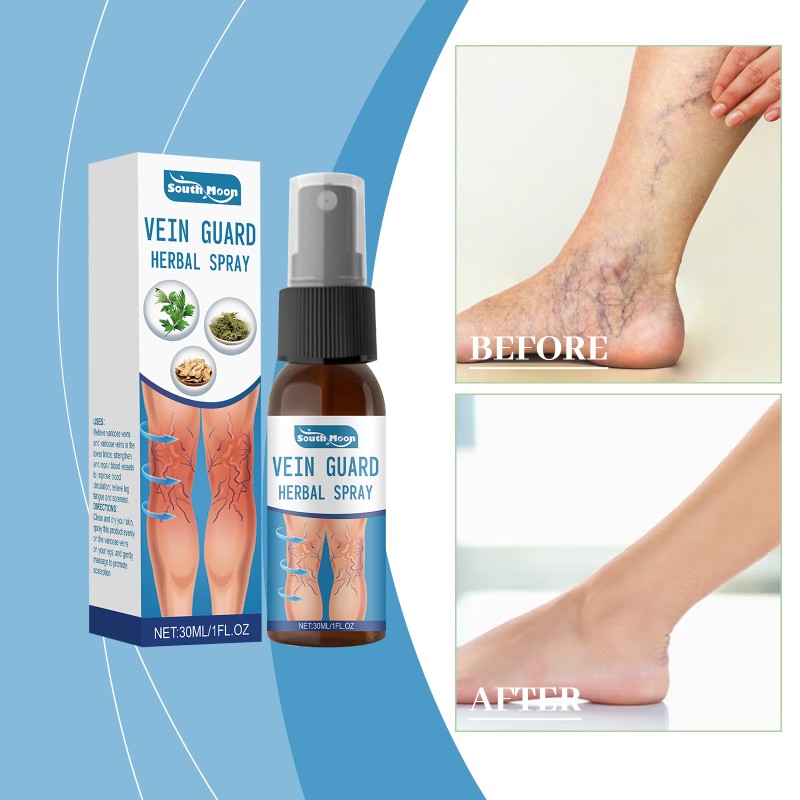 Varicose Vein Spray Supplier - Plant Extract Leg Fatigue Relief