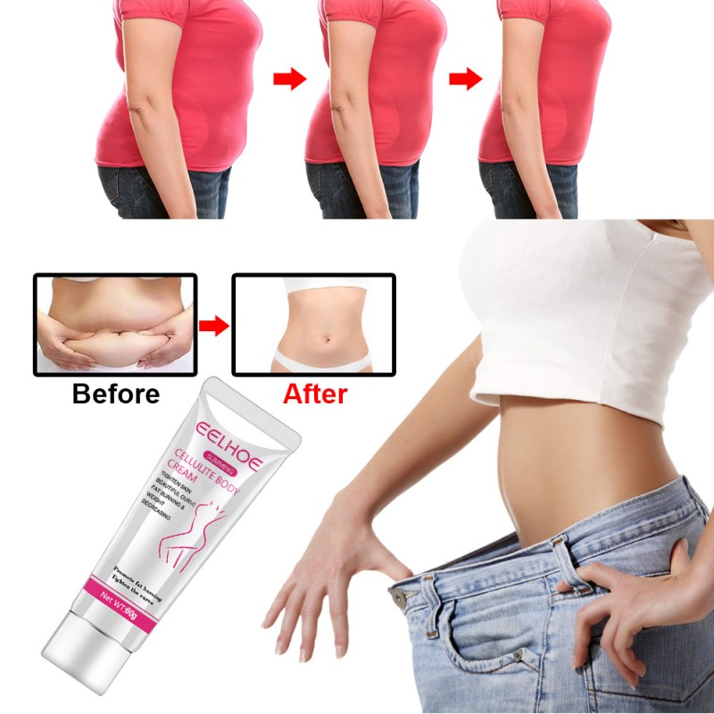 Slimming Cream Supplier - Waist Abdomen Shaping Fat Burning