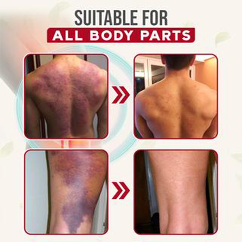 Bruise Spray Manufacturer - Muscle Strain Ankle Knee Pain Relief