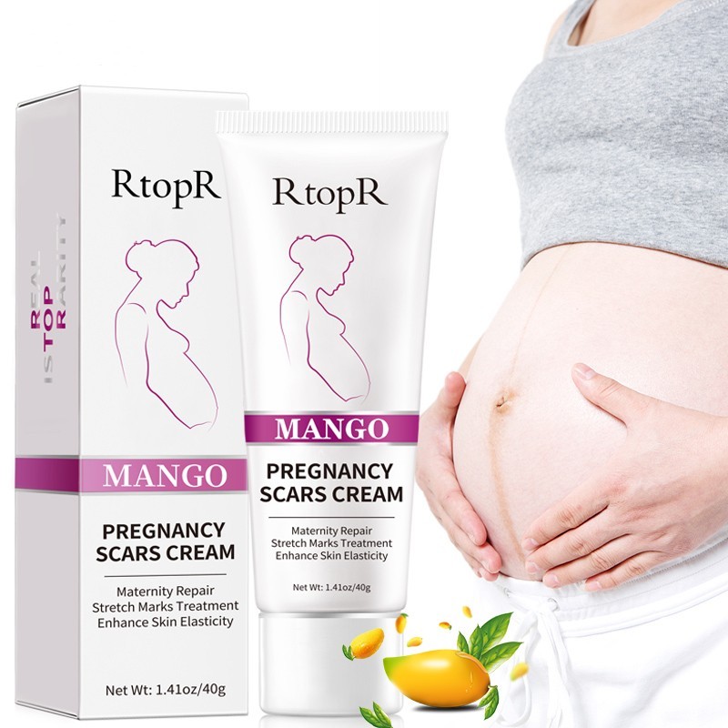 Pregnancy Mark Cream Factory - Mango Scars Acne Stretch Marks Treatment