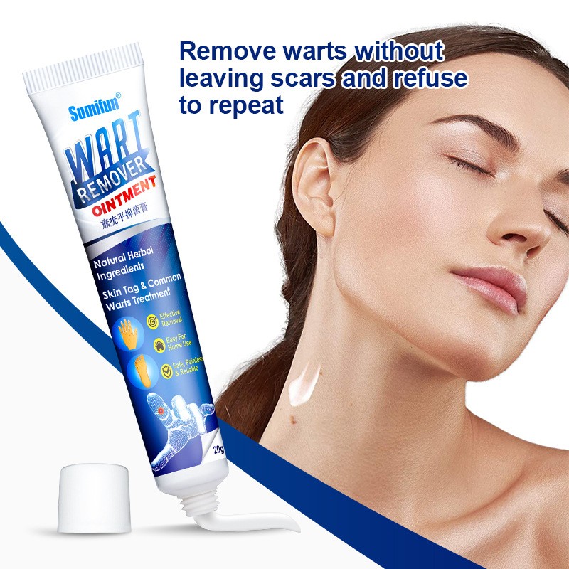 Wart Ointment Supplier - Natural Extract Skin Tag Remover Cream
