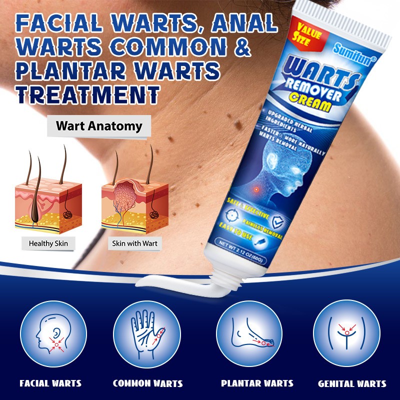 Genital Wart Remover Factory - Sumifun Warts Removal Skin Care