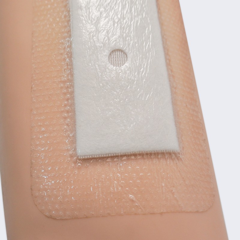 Hydrocolloid Dressing Manufacturer - OEM Custom for Pressure Ulcers Bulk