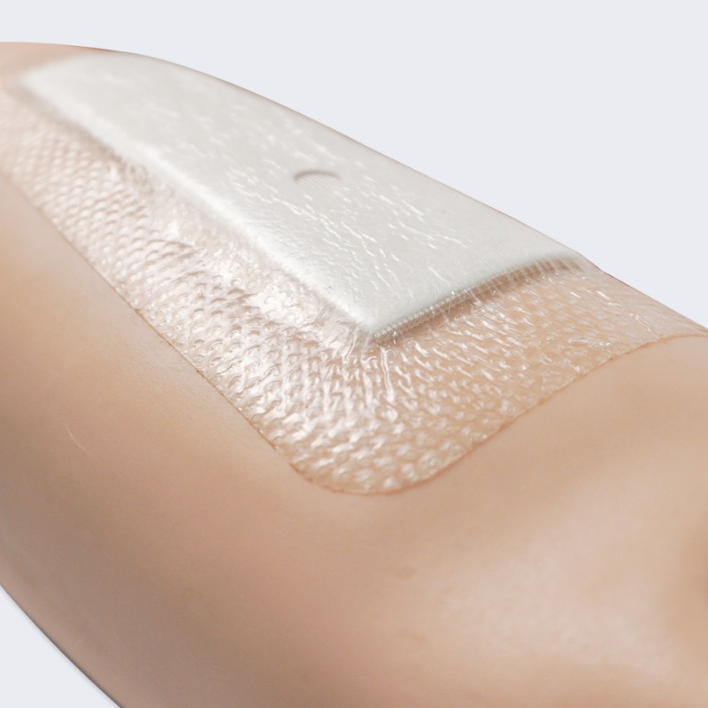 Hydrocolloid Dressing Manufacturer - OEM Custom for Pressure Ulcers Bulk