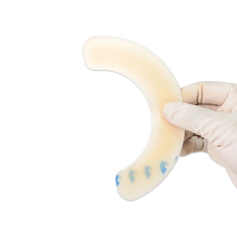 Ostomy Barrier Ring Manufacturer - Hydrocolloid Skin Barrier Accessories