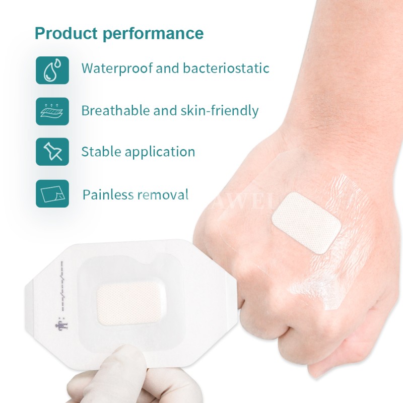Transparent Wound Dressing Factory - Island Dressing IV Catheter Cover