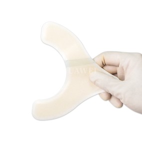 Ostomy Barrier Strips Manufacturer - Wholesale Leak Proof Hydrocolloid