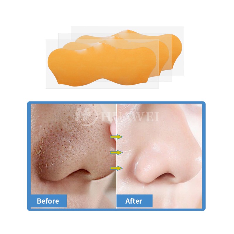 Blackhead Nose Strips Factory - Custom Logo Private Label Men Women