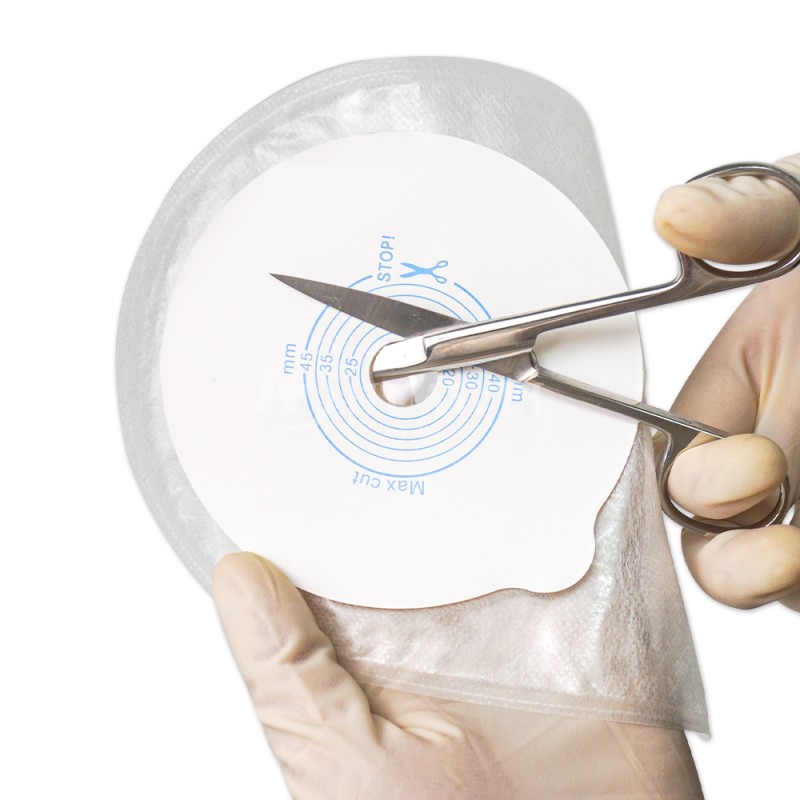 Colostomy Bag Manufacturer - 2025 Medical Consumables One-Piece