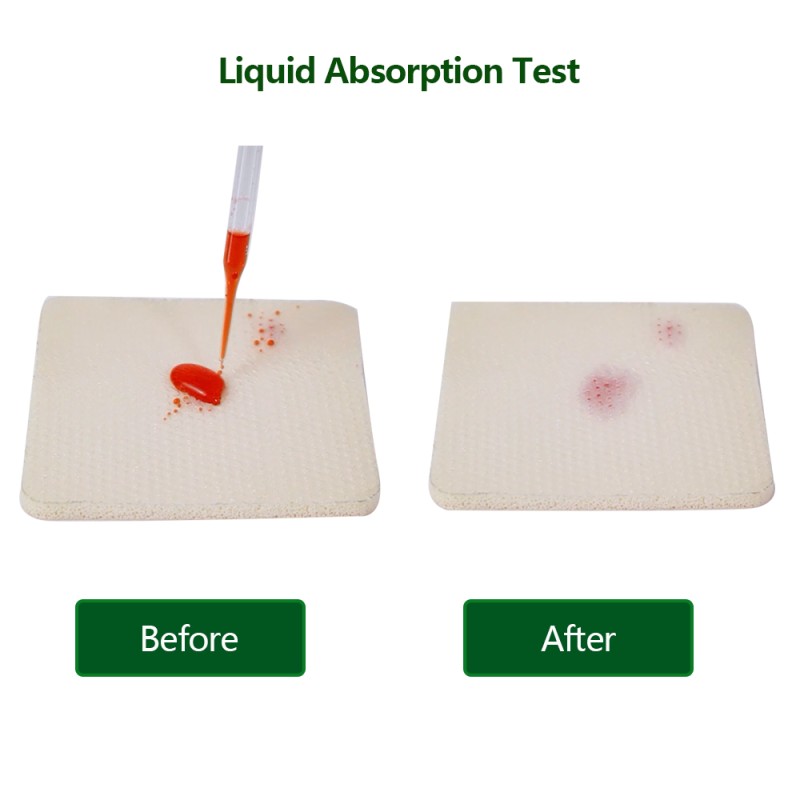 Medical Foam Dressing Factory - Custom Non-adhesive Blue Foam Bandages