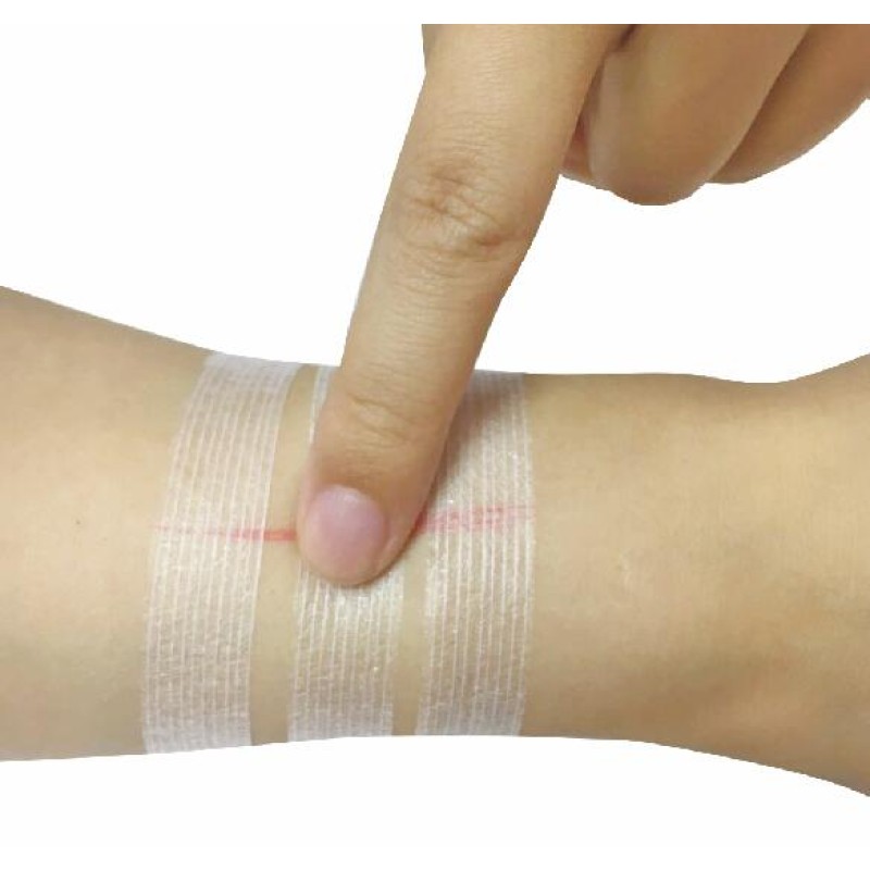 Wound Closure Strip Factory - Transparent Medical Suture Material