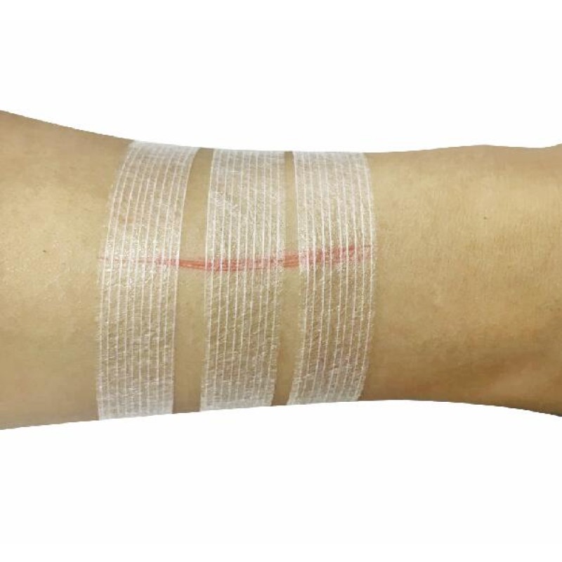 Wound Closure Strip Factory - Transparent Medical Suture Material