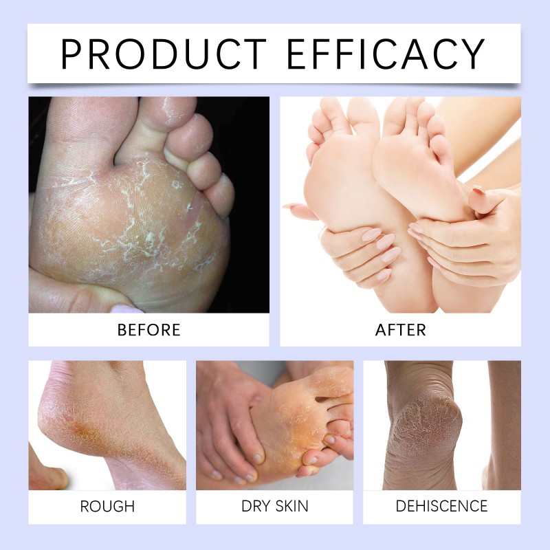 Foot Care Cream Manufacturer - Roughness Alleviate Smoothing
