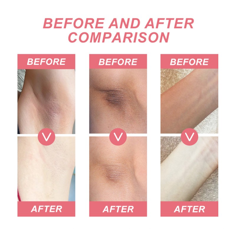 Brightening Gel Supplier - Dark Underarms Bikini Area