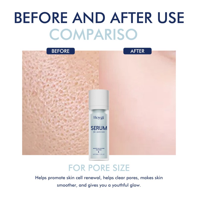 Acid Serum Supplier - Pore Minimizing Deep Hydration