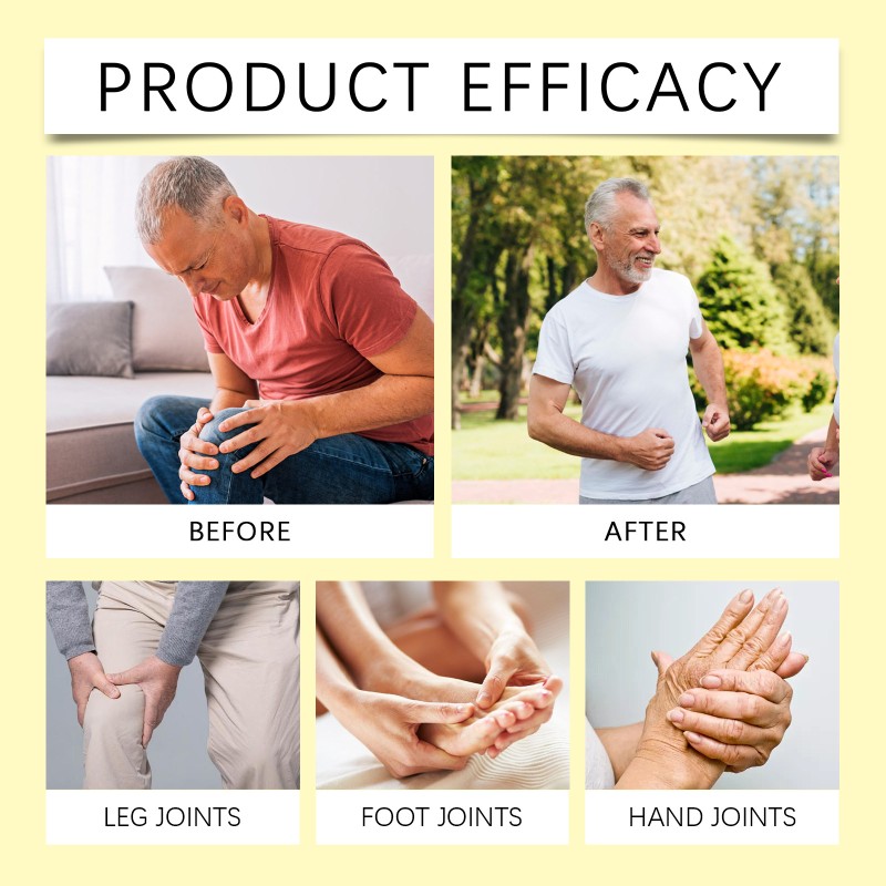 Joint Cream Supplier - Bee Venom Active Recovery Cream Custom