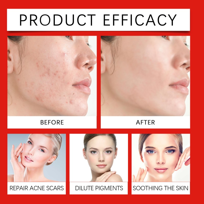 Beard Oil Supplier - Organic Regrowth Nourishing