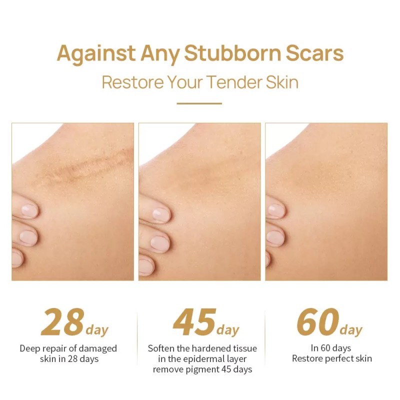 Scar Cream Supplier - Pimple Scar Removal Smooth Skin