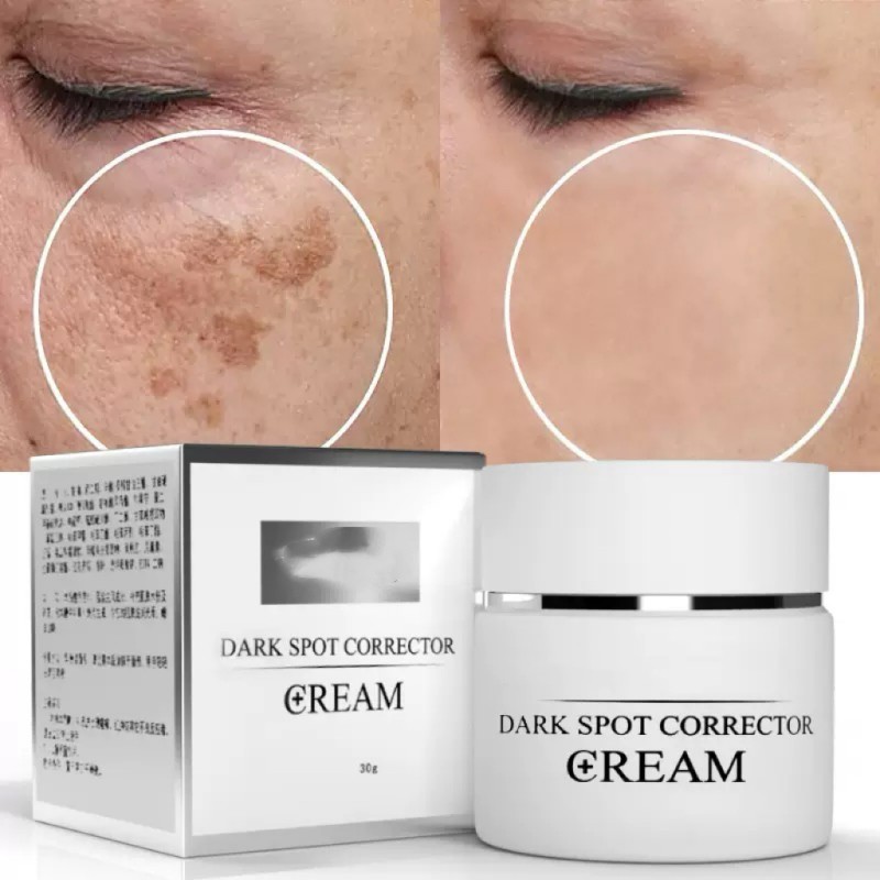Dark Spot Corrector Supplier - Skin Care Cream for Spots Removal