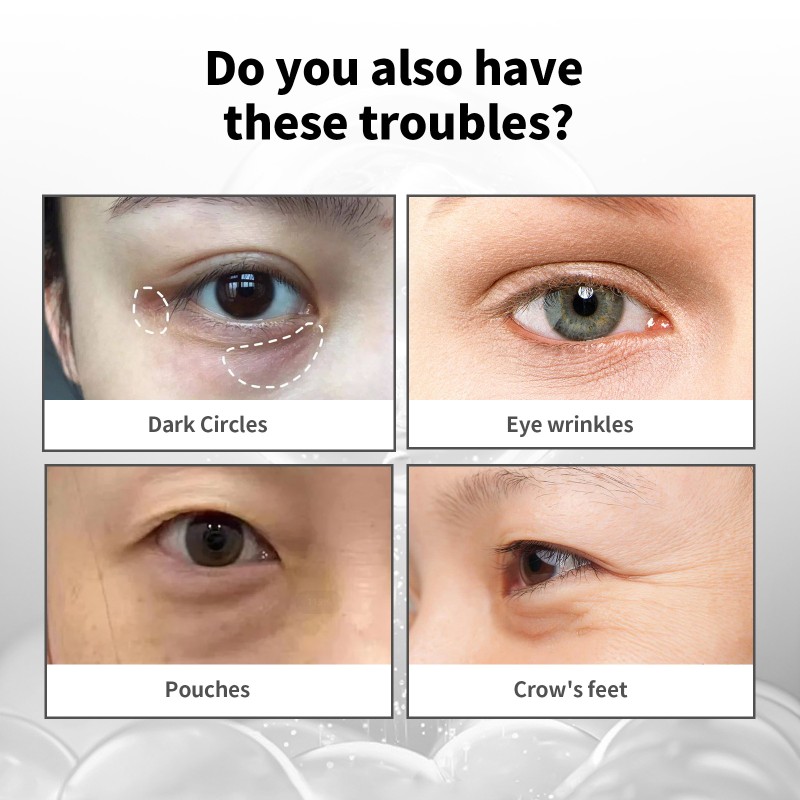 Eye Cream Factory - Anti Wrinkle Bags Removal