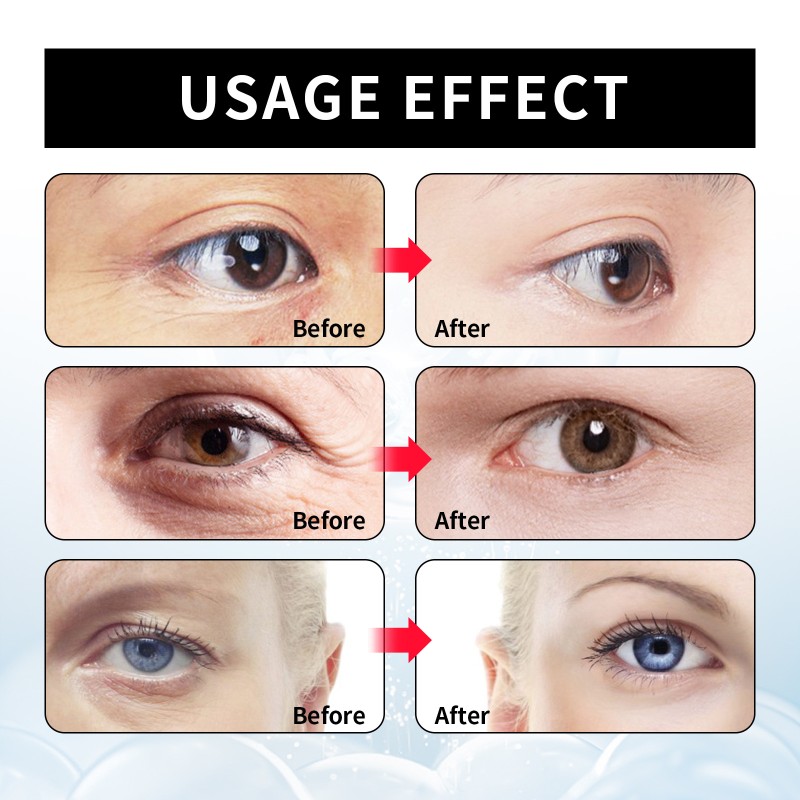 Eye Cream Factory - Anti Wrinkle Bags Removal