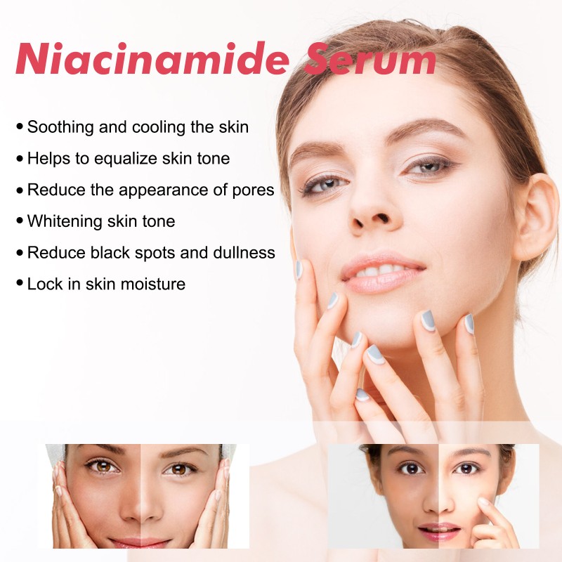 Spot Serum Factory - Nicotinamide Tone Equalizing