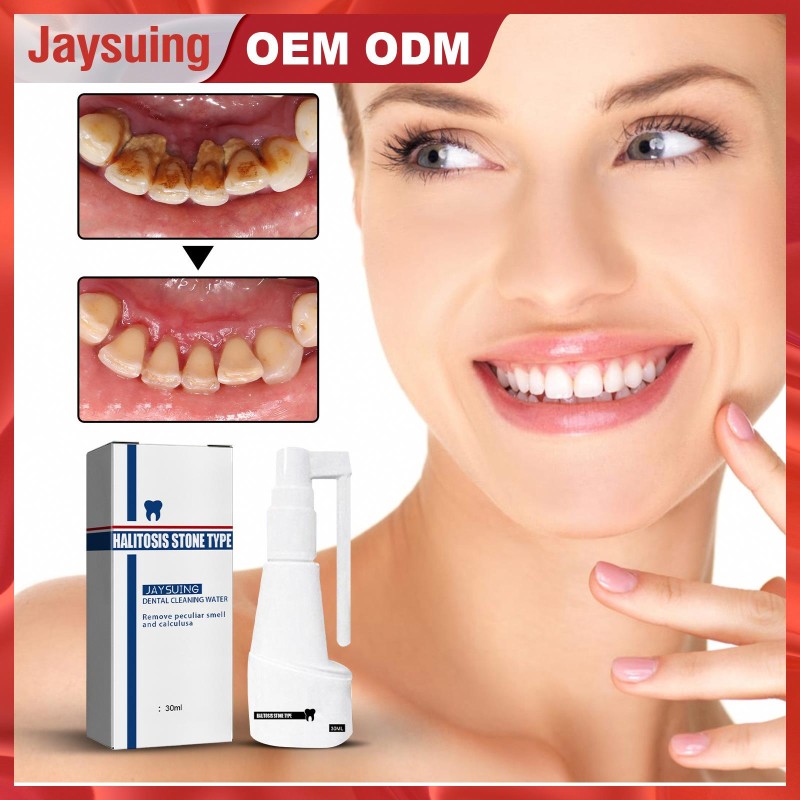 Teeth Whitening Spray Factory - Jaysuing Dental Calculus Dissolving Oral