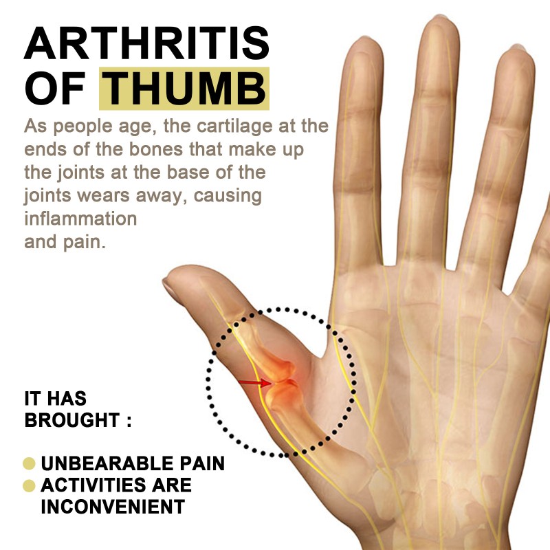 Arthritis Patch Manufacturer - Free Shipping Thumb Pain Relief Wholesale