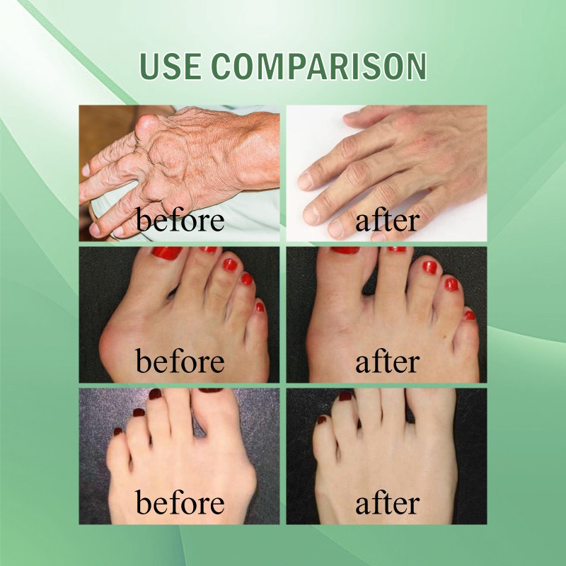 Joint Collagen Cream Manufacturer - South Moon Body Pain Relief Protein