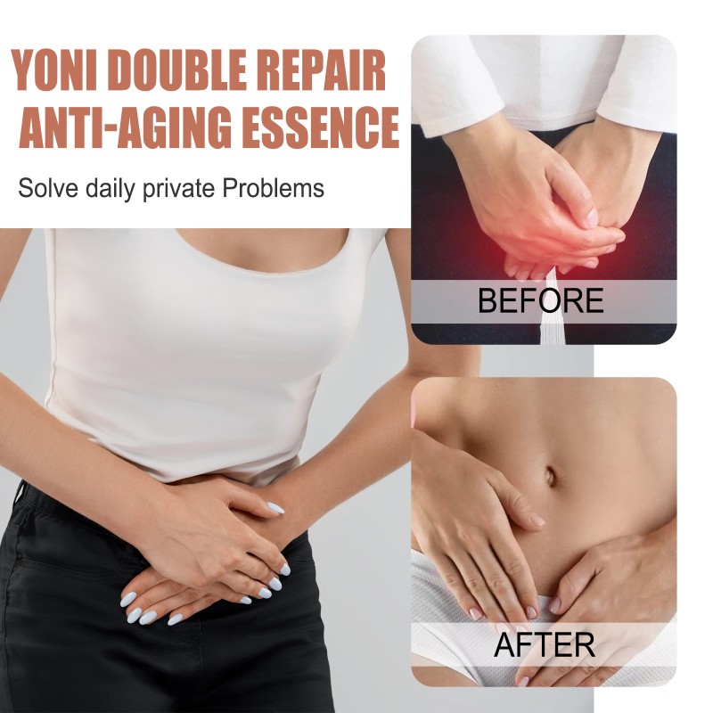 Intimate Care Essence Factory - South Moon Female Yoni Double Repair