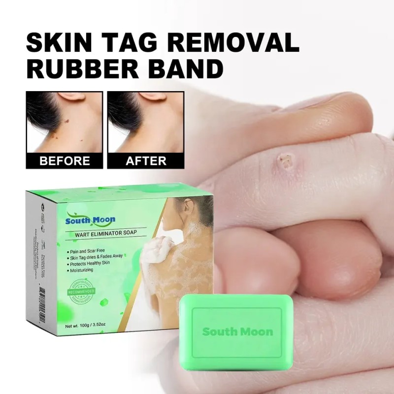 Handmade Soap Manufacturer - South Moon Brightening Acne Wart Removal