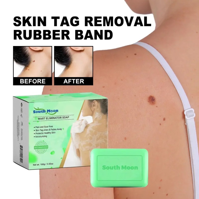 Handmade Soap Manufacturer - South Moon Brightening Acne Wart Removal