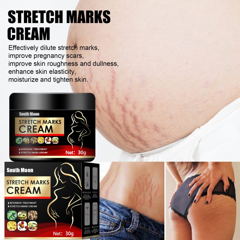 Stretch Mark Cream Factory - South Moon Postpartum Scar Removal Women