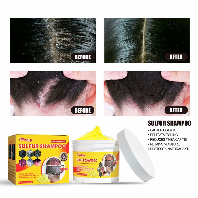 Sulfur Shampoo Manufacturer - South Moon Anti Dandruff Itchy Scalp Care