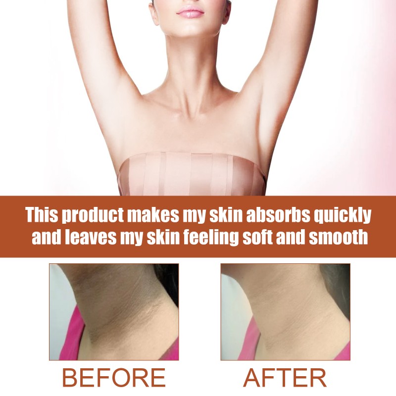 Skin Repair Spray Manufacturer - South Moon Dark Spots Elbows Knees