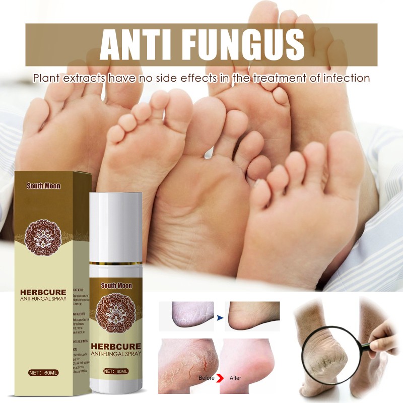Foot Odor Spray Factory - Herbal Anti Fungal Deodorant Bad Smell Feet