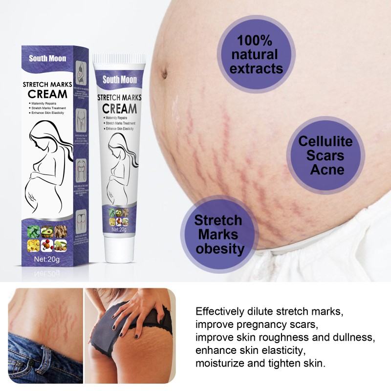 Stretch Mark Cream Factory - South Moon Mango Mark Remover Cream