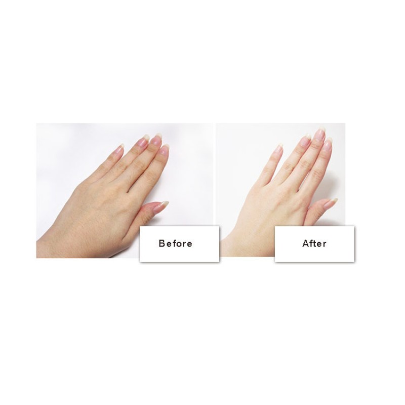 Warmer Supplier - U-Shaped 8 Hours