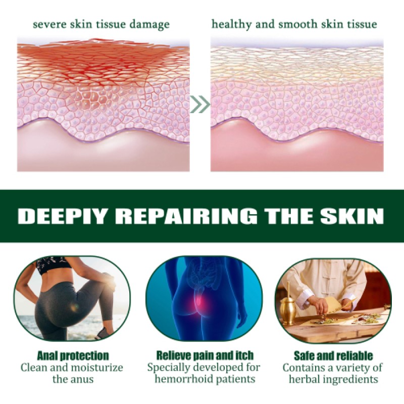 Wood Roller Manufacturer - Hump Correction Massage