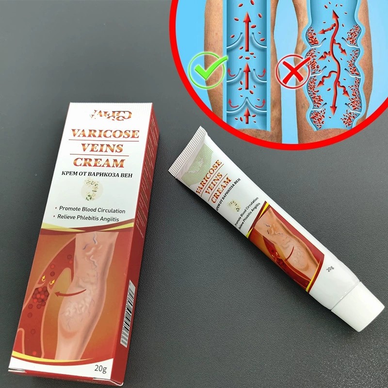 Varicose Veins Cream Factory - Herbal Pain Relief Spider Veins Legs