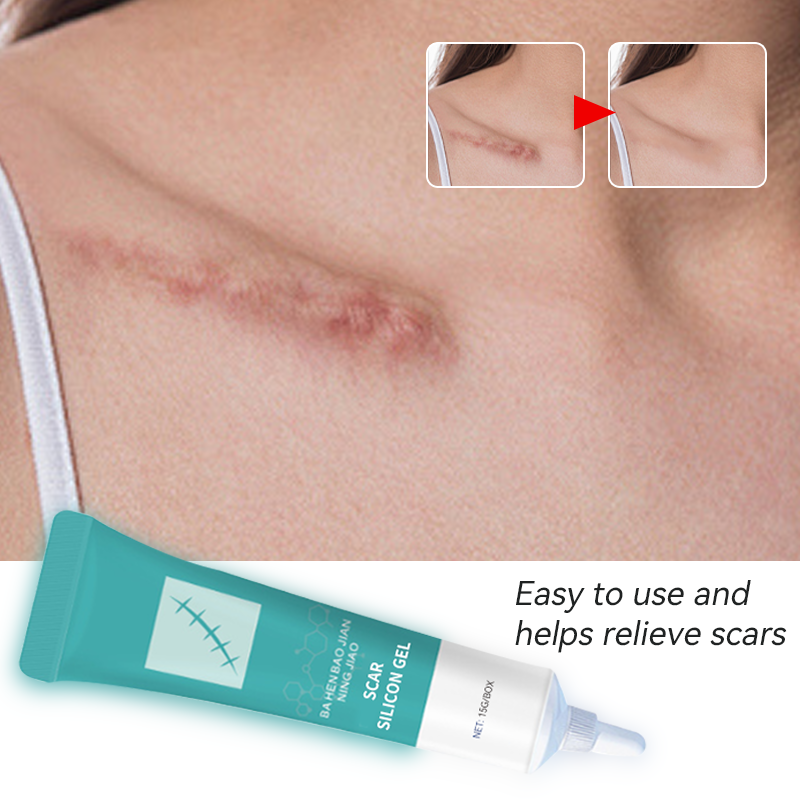 Scar Cream Manufacturer - Medical Silicone Old Scars Legs Clear