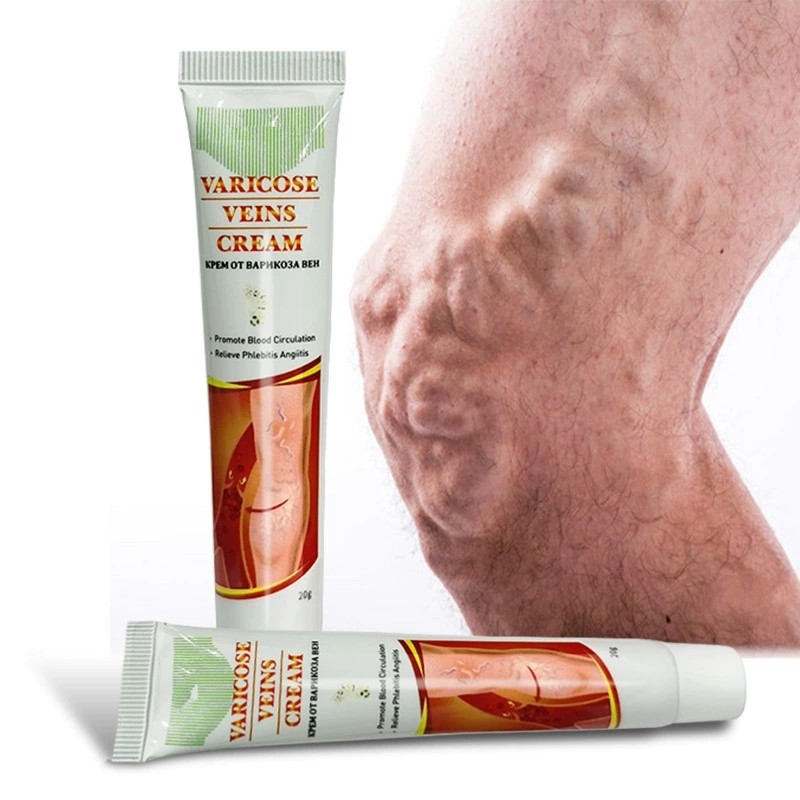 Varicose Veins Cream Factory - Herbal Pain Relief Spider Veins Legs