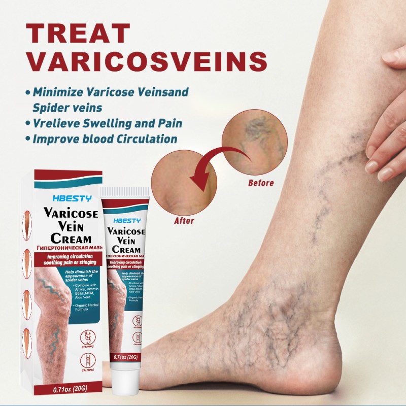 Varicose Veins Cream Manufacturer - Natural Horse Chestnut Leg Discomfort
