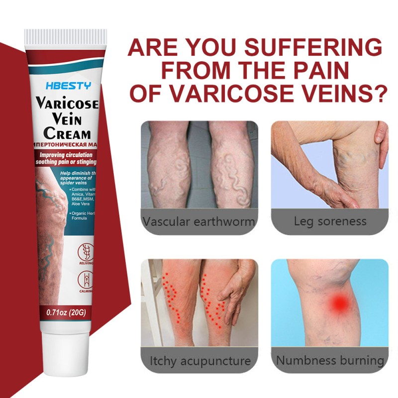 Varicose Veins Cream Manufacturer - Natural Horse Chestnut Leg Discomfort
