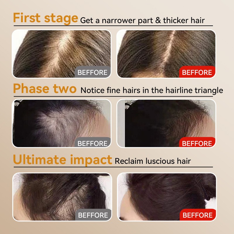 Hair Loss Shampoo Manufacturer - Ginger Nourishing Adult Prevention