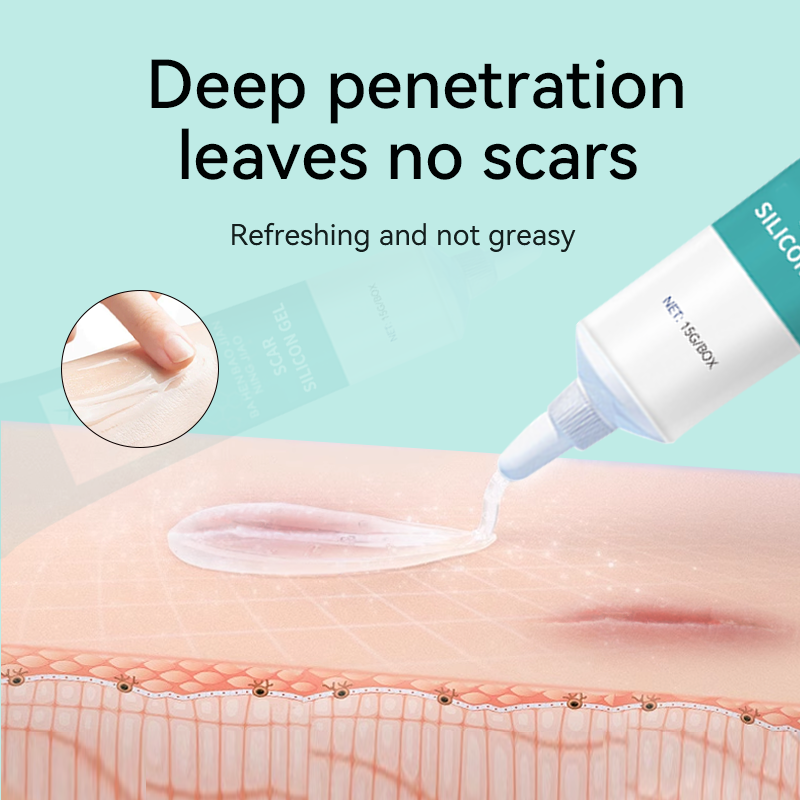 Silicone Scar Gel Manufacturer - OEM ODM 15ml Medical Skin Repair