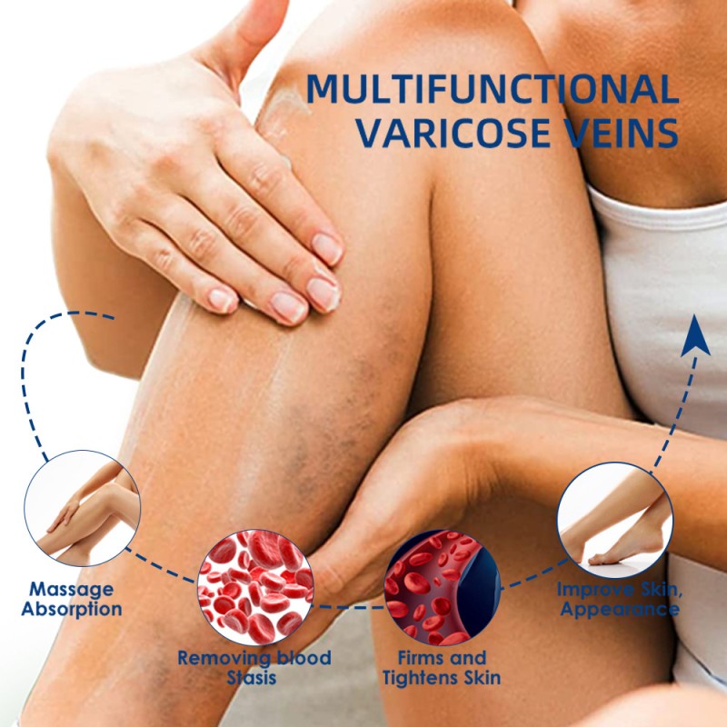 Varicose Veins Cream Factory - Herbal Extract Relieves Swelling Aching
